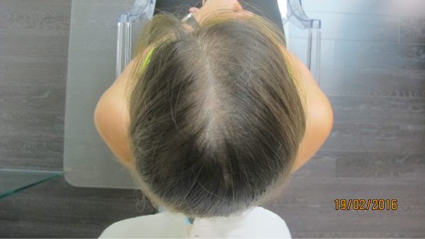 Woman Hair Loss Natural Herbal Shampoo Treatment